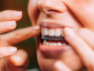 Closeup of patient putting on whitening strip