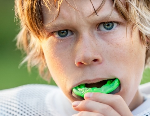 Teen placing an athletic mouthguard