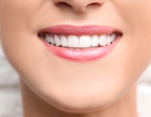 Closeup of flawless smile after cosmetic dental bonding