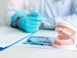 a model of dentures on a table
