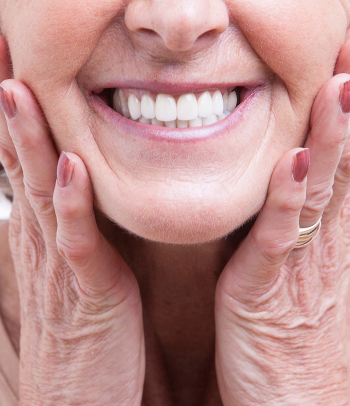 a woman smiling with dentures in San Juan Capistrano