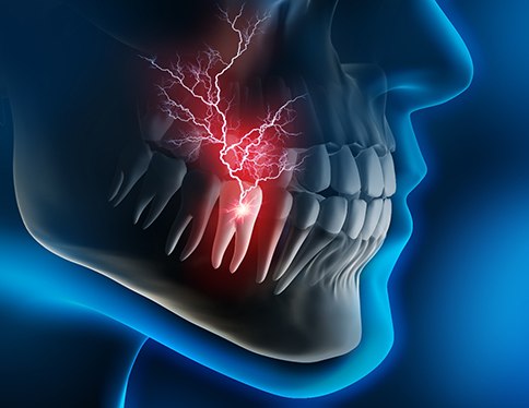 electricity shooting through a tooth