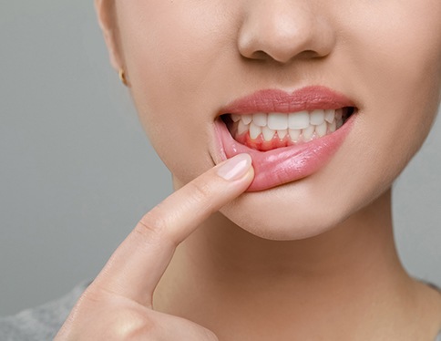 Nose-to-neck view of woman pulling down lower lip with a single finger to reveal red gums