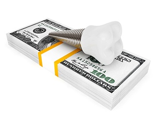 implant on money representing cost of dental implants in San Juan Capistrano