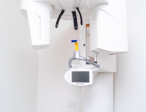 3 D C T cone beam imaging scanner