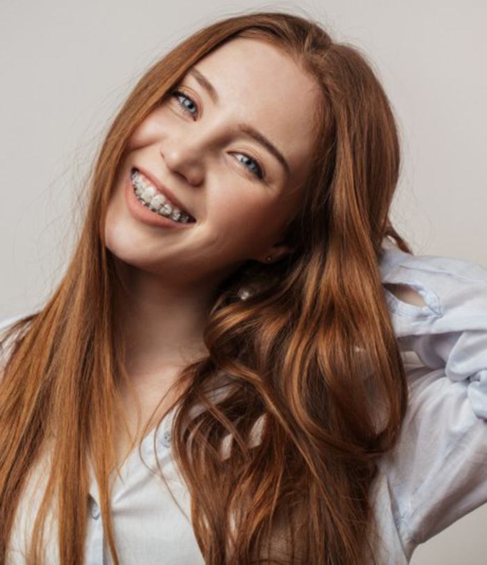 Teen smiles with braces