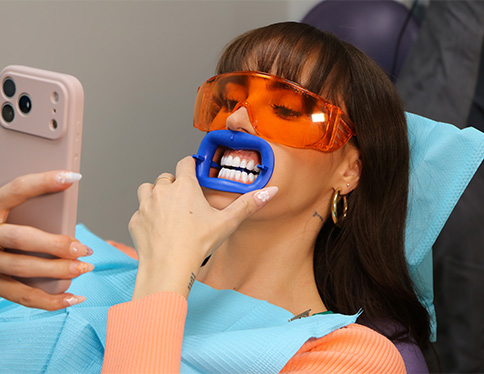 Woman brushing her whitened teeth