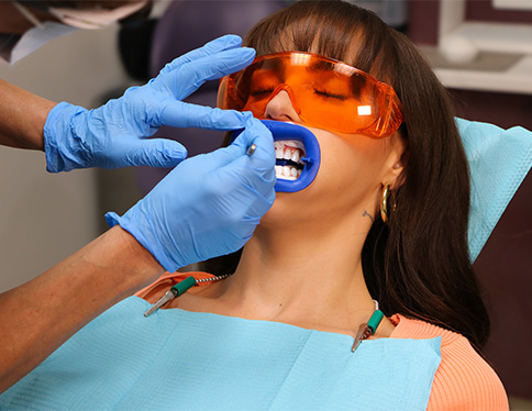 Man smiling wide with whitened teeth