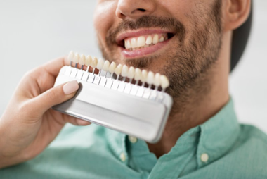 Patient smiling while dentist color-matches a row of veneers to his teeth